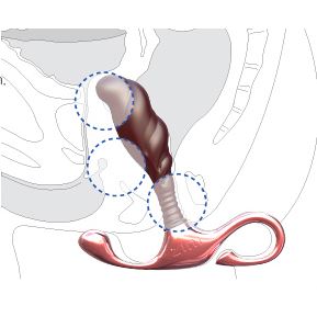 ZINI Janus Iron 前列腺按摩器 所有前列腺按摩器 購買